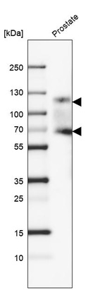 Western blot analysis in human prostate tissue.