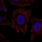 Anti-MYO10 Antibody
