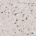 Anti-MYO10 Antibody