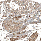 Anti-MYO10 Antibody