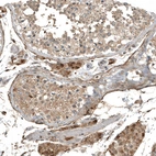 Immunohistochemical staining of human testis shows strong cytoplasmic positivity in Leydig cells.