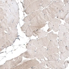 Immunohistochemical staining of human skeletal muscle shows very weak cytoplasmic positivity in myocytes as expected.