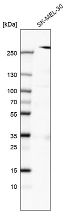 Western blot analysis in human cell line SK-MEL-30.