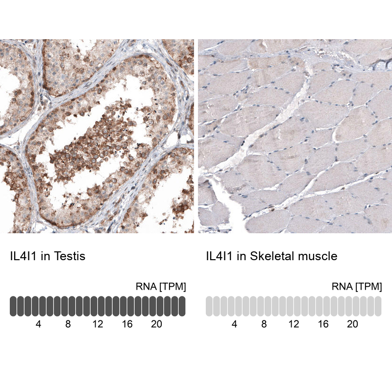 Anti-IL4I1 Antibody