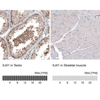 Anti-IL4I1 Antibody