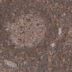 Immunohistochemical staining of human lymph node shows moderate to strong cytoplasmic positivity in non-germinal center cells.