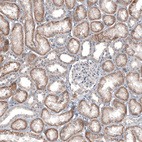 Immunohistochemical staining of human kidney shows no positivity in cells in glomeruli.