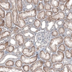 Immunohistochemical staining of human kidney shows no positivity in cells in glomeruli.
