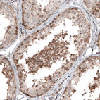 Immunohistochemical staining of human testis shows moderate cytoplasmic positivity in cells in seminiferous ducts.
