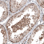 Immunohistochemical staining of human testis shows moderate cytoplasmic positivity in cells in seminiferous ducts.