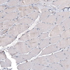 Immunohistochemical staining of human skeletal muscle shows low positivity in myocytes as expected.
