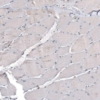 Immunohistochemical staining of human skeletal muscle shows low positivity in myocytes as expected.