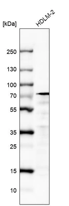 Western blot analysis in human cell line HDLM-2.
