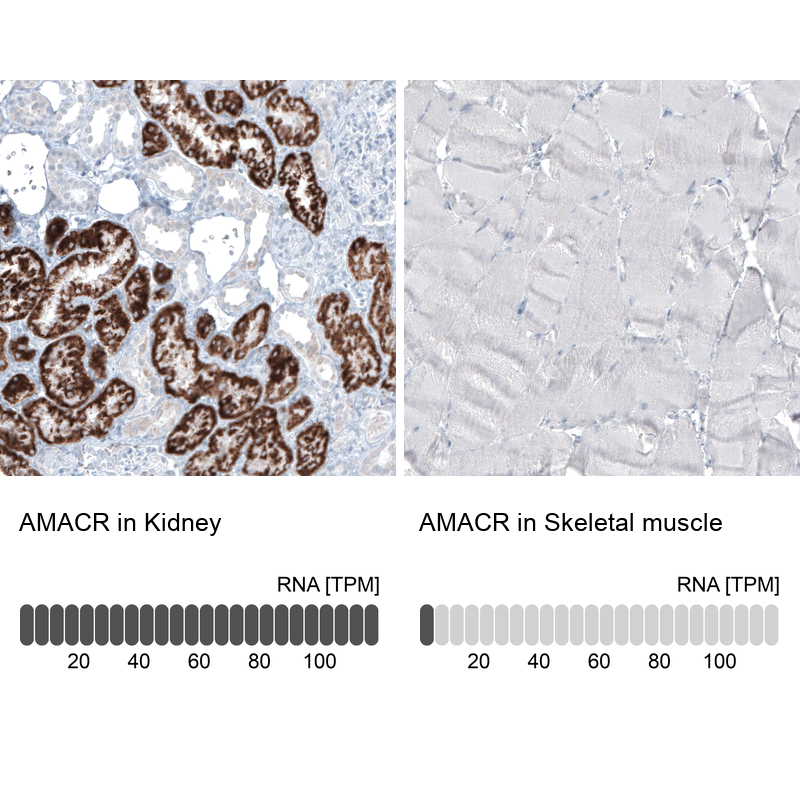 Anti-AMACR Antibody