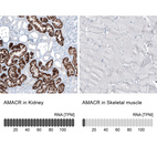 Anti-AMACR Antibody