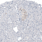 Anti-AMACR Antibody