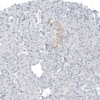 Immunohistochemical staining of human pancreas shows weak granular cytoplasmic positivity in islets of Langerhans.
