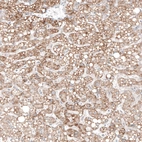 Immunohistochemical staining of human liver shows moderate granular cytoplasmic positivity in hepatocytes.