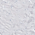 Immunohistochemical staining of human skeletal muscle shows no positivity in myocytes as expected.