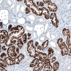 Immunohistochemical staining of human kidney shows strong granular cytoplasmic positivity in cells in proximal tubules.
