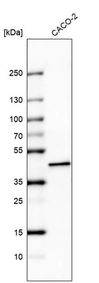 Western blot analysis in human cell line CACO-2.