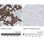 Anti-AMACR Antibody