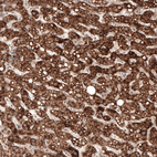 Immunohistochemical staining of human liver shows strong granular cytoplasmic positivity in hepatocytes.