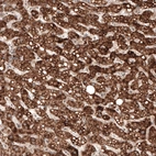 Immunohistochemical staining of human liver shows strong granular cytoplasmic positivity in hepatocytes.