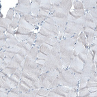 Immunohistochemical staining of human skeletal muscle shows no positivity in myocytes as expected.