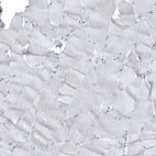 Immunohistochemical staining of human skeletal muscle shows no positivity in myocytes as expected.