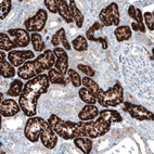 Immunohistochemical staining of human kidney shows strong granular cytoplasmic positivity in cells in proximal tubules.