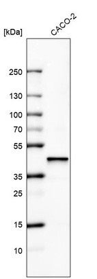 Western blot analysis in human cell line CACO-2.