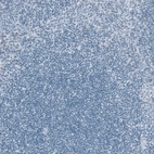 Immunohistochemical staining of human tonsil shows no positivity in non-germinal center cells as expected.