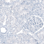 Immunohistochemical staining of human kidney shows no positivity in cells in tubules as expected.