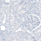 Immunohistochemical staining of human kidney shows no positivity in cells in tubules as expected.