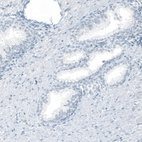 Immunohistochemical staining of human prostate shows no positivity in glandular cells as expected.