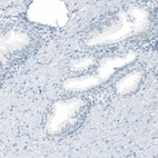 Immunohistochemical staining of human prostate shows no positivity in glandular cells as expected.