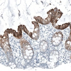 Immunohistochemical staining of human rectum shows strong membranous / cytoplasmic positivity in glandular cells.