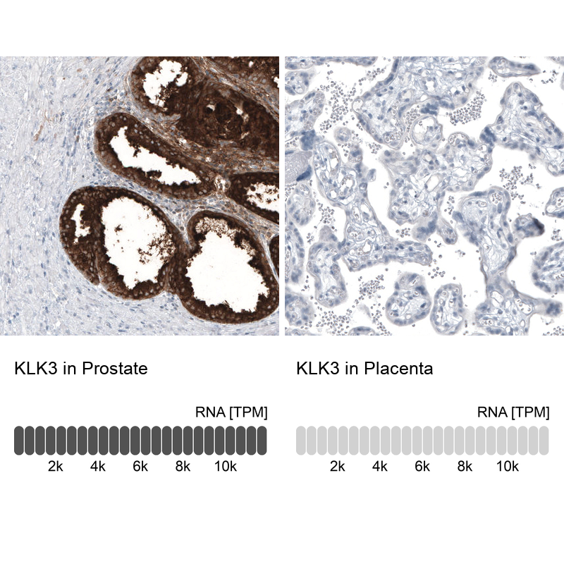 Anti-KLK3 Antibody