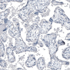 Anti-KLK3 Antibody