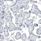 Immunohistochemical staining of human placenta shows no positivity in trophoblastic cells as expected.