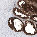 Immunohistochemical staining of human prostate shows strong cytoplasmic positivity in glandular cells.