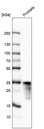Western blot analysis in human prostate tissue.
