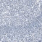 Immunohistochemical staining of human tonsil shows no positivity in non-germinal and germinal center cells as expected.