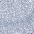 Immunohistochemical staining of human tonsil shows no positivity in non-germinal and germinal center cells as expected.