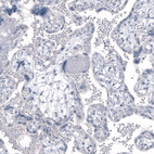 Anti-KLK3 Antibody