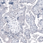 Immunohistochemical staining of human placenta shows no positivity in trophoblastic cells as expected.