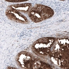 Immunohistochemical staining of human prostate shows strong cytoplasmic positivity in glandular cells.