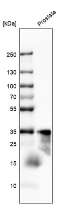 Western blot analysis in human prostate tissue.