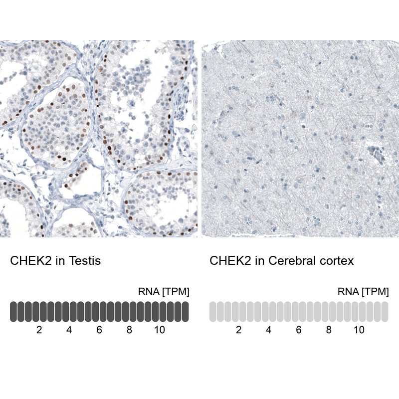 Anti-CHEK2 Antibody